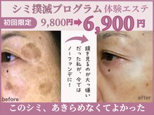 スイッチ(Switch)の雰囲気（シミのお悩みご相談ください。カウンセリング付きエステ♪）