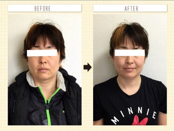 美容整体ウェリナ あま甚目寺院/小顔矯正/骨盤矯正/美脚サロン