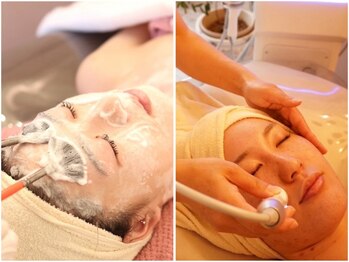 リエラ(Liella)の写真/憧れの韓国女優肌へ!【全顔♪ララピール+毛穴洗浄★¥6980】話題の韓国肌管理♪毛穴開きもキュッと引締め