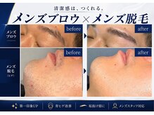 ノビシロホワイトニング(nobi-SHIROホワイトニング)の雰囲気（メンズ人気No. 1のヒゲ光脱毛◎男性スタッフが対応）