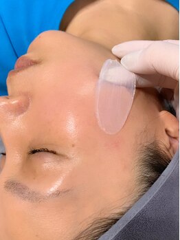 リサロン エヌ(Re salon N)の写真/【毛穴専門店】ワックス脱毛で毛穴汚れ・産毛をツルっと撃退！ピーリング効果で肌トーンも明るく♪