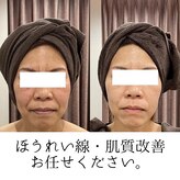 リライズ 磐田(Rerise)