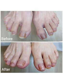 リゼラアンドコー 宇都宮陽南店/ドイツ式フットケア専門店