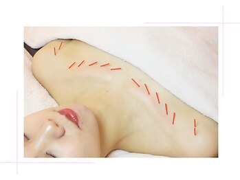 メイロン(meilong)/デコルテ美鍼