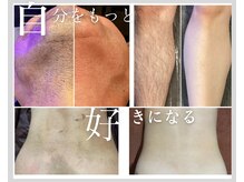 サロン エス(salon S)の雰囲気（国内産の機械でスピード脱毛！）