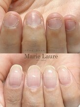 マリーロール 淀屋橋本店(Marie Laure)/自爪育成/深爪矯正/ネイルケア