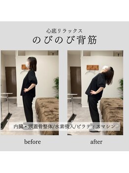 整体院 バイオリハ(Bio_Reha.)/【姿勢改善】