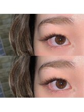 ブロッサ(Blossa)/バインドロック