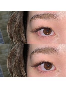 ブロッサ(Blossa)/バインドロック