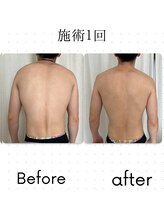 アカアカ('AKA'AKA)/ヘッドスパ