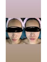 シレーヌ(Sirene)/★フェイシャル★美肌効果も◎