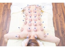 リオ(RIO)/カッピング