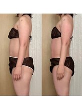 ココア(CoCoa)/活性リンパ洗浄