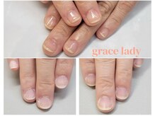 グレースレディ/爪は修復能力がありません