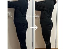 ヨサパーク リアン(YOSA PARK Lien)/モニター様before→after/痩身