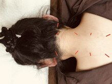 リバー鍼灸院(river鍼灸院)