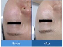 エクラ アン(eclat.un)/ダクトピール　女性