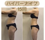 ビボーン ボディ(美bone body)