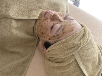 ティセ(TisseR)の写真/毛穴レスなクリア肌へ！ハーブピーリングで輝くハリ艶を実感しませんか？◎(40文字)