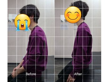 ナオル整体 西川口院(NAORU整体)/お客様のbefore/after　座位