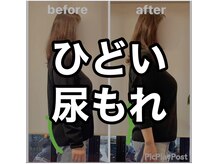 カワル整体 上通り院/尿もれにお悩みのあなたへ