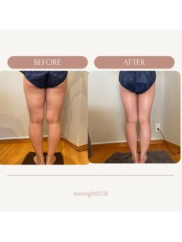 テン エイト(10 8)/下がったヒップ撃退!