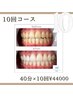 【セット割◎】セルフホワイトニング10セット（1セット：20分×2）￥44000