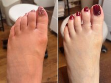 フス(FUSS)/foot&bodycare FUSS