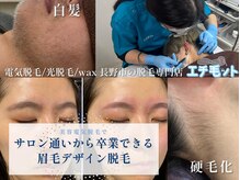 エチ毛ット