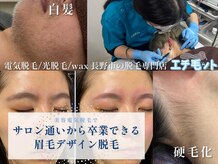 エチ毛ット