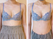 ベリンダ(belinda)/二の腕ケアしながらバストアップ