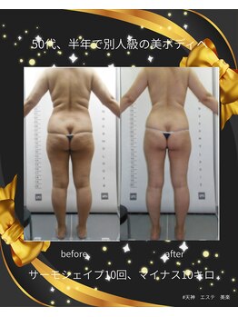 美楽/サーモシェイプ全身の結果です