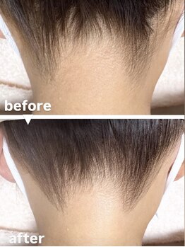 メゾン ド クロエ(Maison de Chloe)/ブライダルシェービング