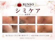 ランソ ビューティー 成田(RUNSO Beauty)の雰囲気(気になるシミを集中ケア♪低周波リアージュで透明感のある肌へ)