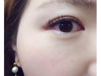 オファーリングビューティーノノ(offering beauty NONO)/【アップ】お悩みを解消