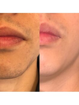 メンズプシュケ(men's PSYCHE)/