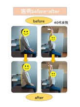 いみすぽ整体/40代女性ビフォアアフター