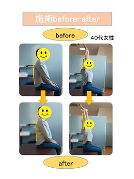 いみすぽ整体/40代女性ビフォアアフター