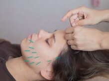 ウーマンビーヘルス(woman Be Health)/美容鍼灸×身体のお悩み改善