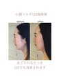 ビーキュート 学芸大学店(BE-CUTE) 二重あごやフェイスライン気になる方、コルギで解消目指せます
