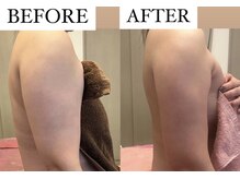 フェミニー(Feminy)/二の腕ケアも大人気！