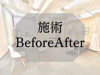 ナオル整体 札幌院(NAORU整体)/札幌円山/整体/猫背/巻き肩