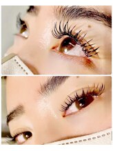 ブロッサ(Blossa)/バインドロック