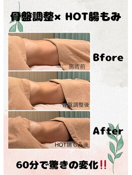 リペララ 中野栄店/腸もみ☆