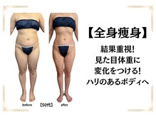 エミニー バイ エルズ(Eminy by L★s)の雰囲気（見た目体重を変えていく痩身）