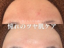 ルアナアイナ 大分