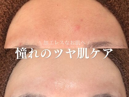 ルアナアイナ 大分の写真