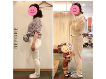 さらさ整骨院/産後ビフォーアフター