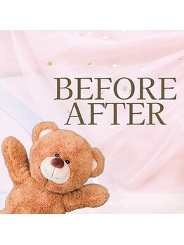 サロン ヴィプラス(SALON Vi+)/BeforeAfter
