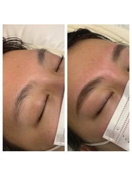 ラ フルール(La Fleur)/ハリウッドブロウリフト